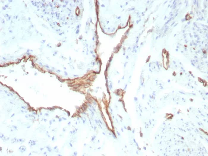 CD31/PECAM-1 Antibody (rPECAM1/8829) Immunohistochemistry-Paraffin: CD31/PECAM-1 Antibody (rPECAM1/8829) [NBP3-23723] -