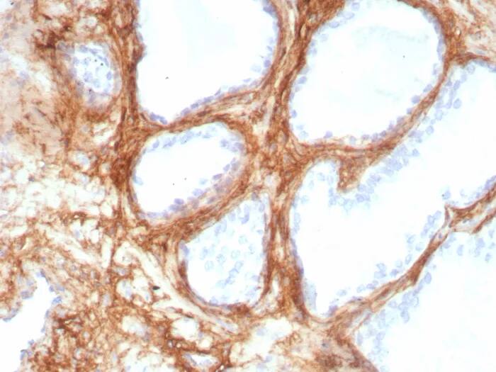 Periostin/OSF-2 Antibody (POSTN/8951R) Immunohistochemistry-Paraffin: Periostin/OSF-2 Antibody (POSTN/8951R) [NBP3-23725] -