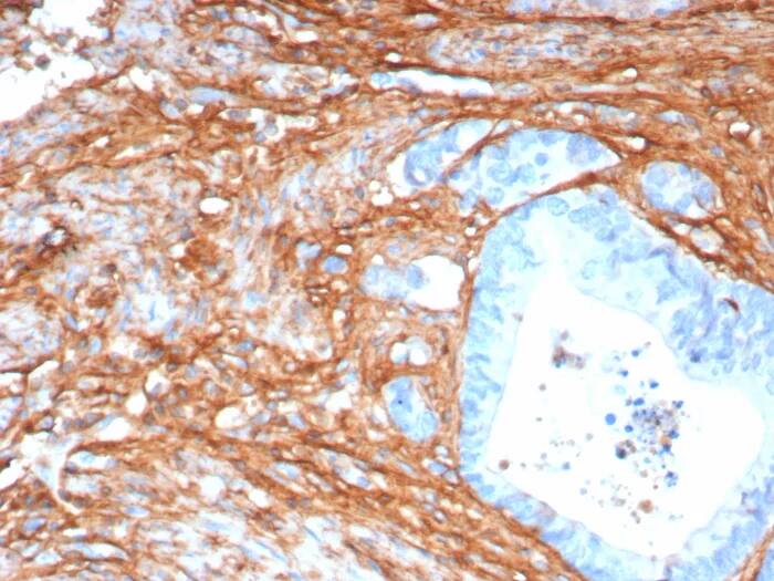 Periostin/OSF-2 Antibody (POSTN/8165R) Immunohistochemistry-Paraffin: Periostin/OSF-2 Antibody (POSTN/8165R) [NBP3-23726] -