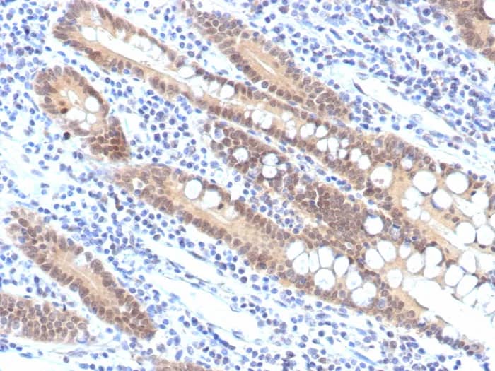 Smad4 Antibody (SMAD/7906R) Immunohistochemistry-Paraffin: Smad4 Antibody (SMAD/7906R) [NBP3-23728] -