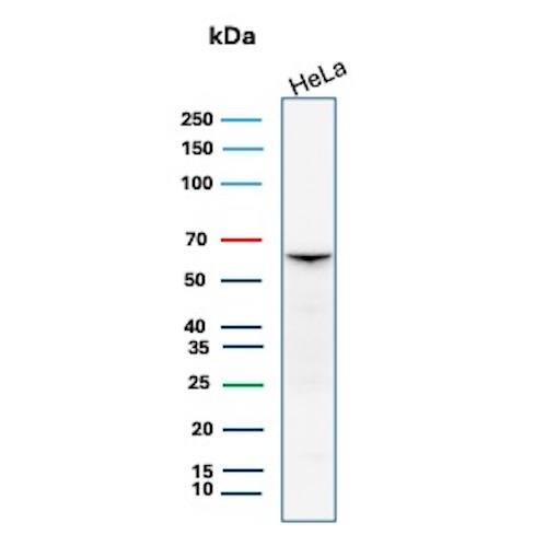 Smad4 Antibody (SMAD/7906R) Western Blot: Smad4 Antibody (SMAD/7906R) [NBP3-23728] -