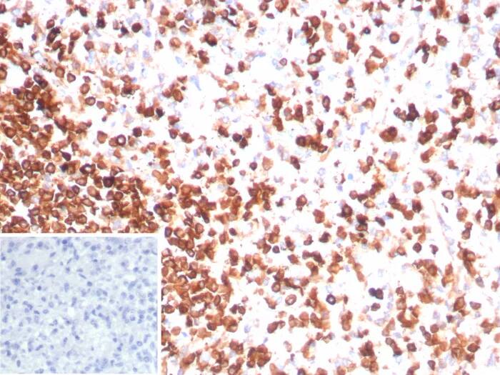 CD3 epsilon Antibody (rC3e/8881) Immunohistochemistry-Paraffin: CD3 epsilon Antibody (rC3e/8881) [NBP3-23733] -