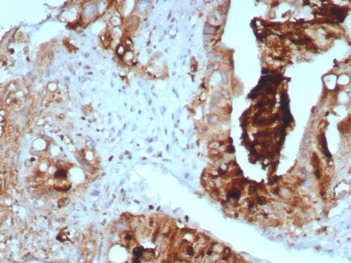 TAG-72 Antibody (TAG72/8317R) Immunohistochemistry-Paraffin: TAG-72 Antibody (TAG72/8317R) [NBP3-23734] -