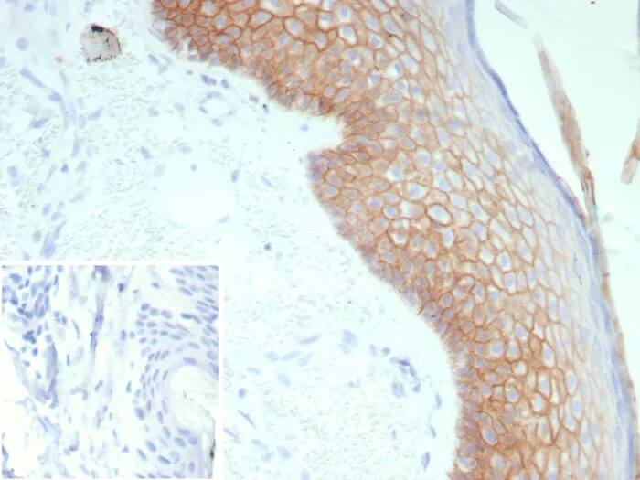 Desmoglein-3 Antibody (rDSG3/8611) Immunohistochemistry-Paraffin: Desmoglein-3 Antibody (rDSG3/8611) [NBP3-23735] -