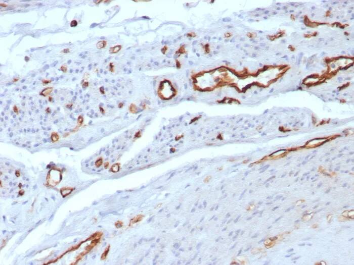 CD31/PECAM-1 Antibody (C31/8592R) Immunohistochemistry-Paraffin: CD31/PECAM-1 Antibody (C31/8592R) [NBP3-23737] -