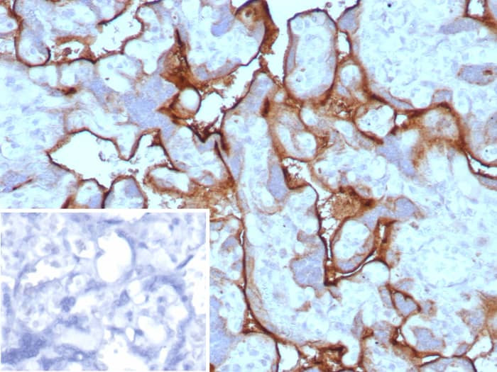 PD-L1 Antibody (PDL1/8591R)