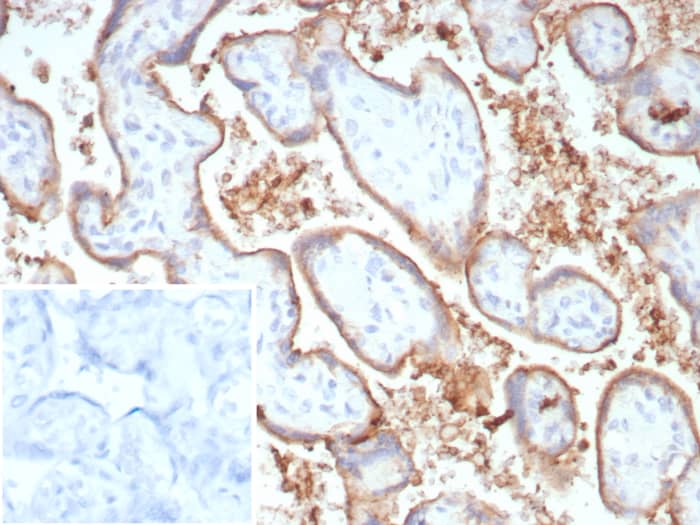 PD-L1 Antibody (PDL1/8809R)