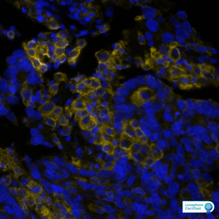 PD-L1 Antibody (PDL1/8809R) PD-L1 in Human Lung Tumor via seqIF™ staining on COMET™
