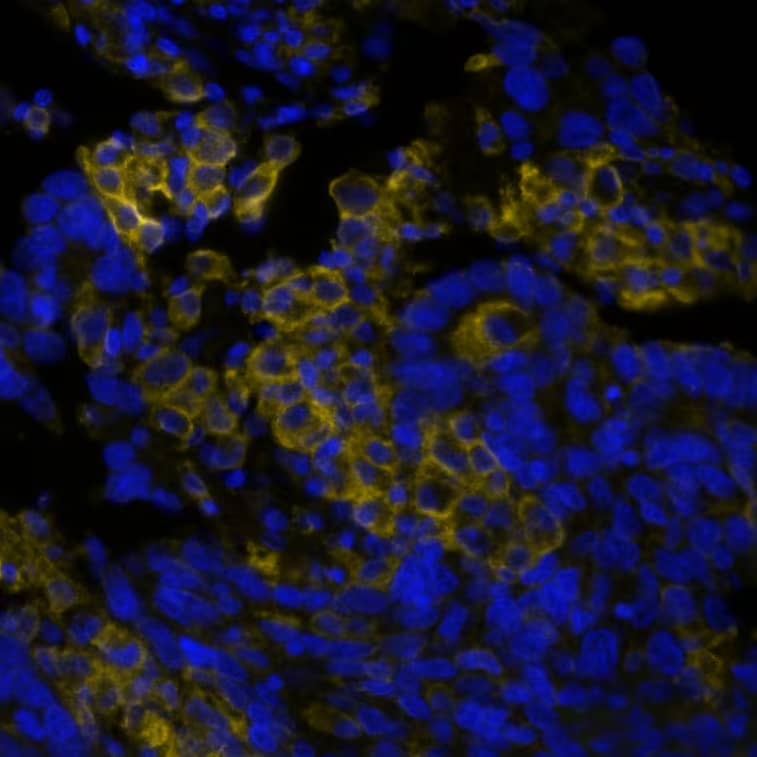 PD-L1 Antibody (PDL1/8809R) PD-L1 in Human Lung Tumor via seqIF™ staining on COMET™