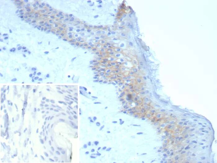 Desmoglein-3 Antibody (DSG3/8251R) Immunohistochemistry-Paraffin: Desmoglein-3 Antibody (DSG3/8251R) [NBP3-23742] -