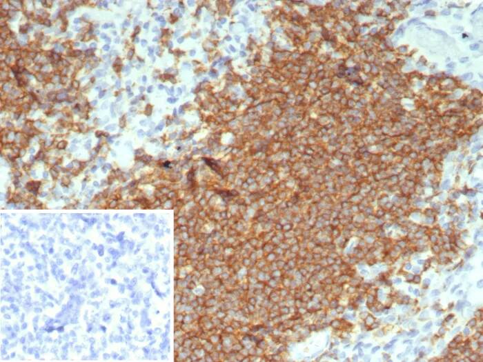 CD20 Antibody (rMS4A1/8044) Immunohistochemistry-Paraffin: CD20 Antibody (rMS4A1/8044) [NBP3-23744] -