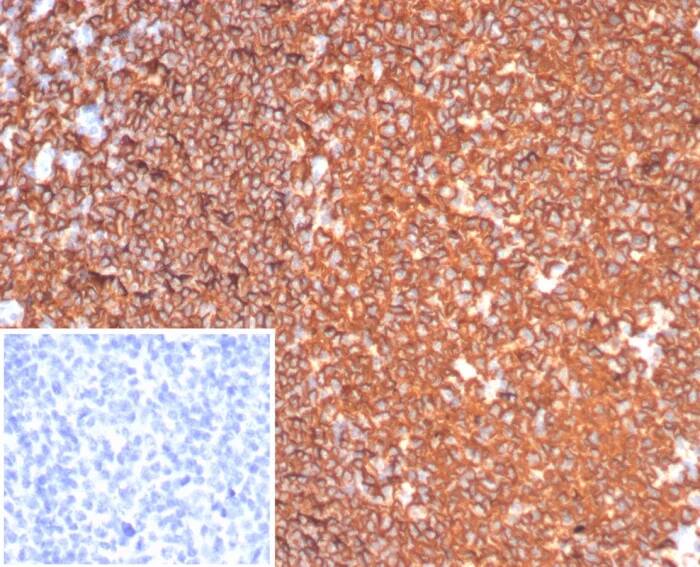 CD20 Antibody (MS4A1/6993R) Immunohistochemistry-Paraffin: CD20 Antibody (MS4A1/6993R) [NBP3-23745] -