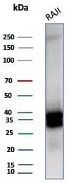 CD20 Antibody (MS4A1/6993R) Western Blot: CD20 Antibody (MS4A1/6993R) [NBP3-23745] -