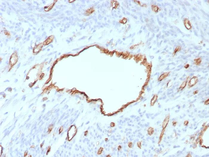 CD31/PECAM-1 Antibody (C31/8593R) Immunohistochemistry-Paraffin: CD31/PECAM-1 Antibody (C31/8593R) [NBP3-23746] -