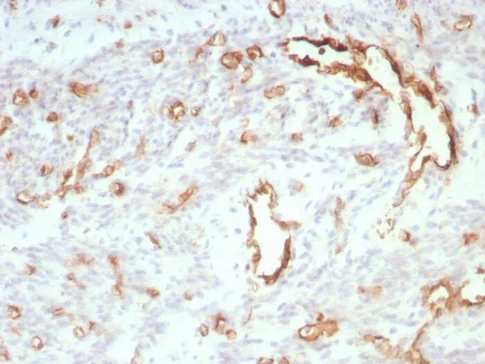 CD31/PECAM-1 Antibody (C31/8828R) Immunohistochemistry-Paraffin: CD31/PECAM-1 Antibody (C31/8828R) [NBP3-23747] -