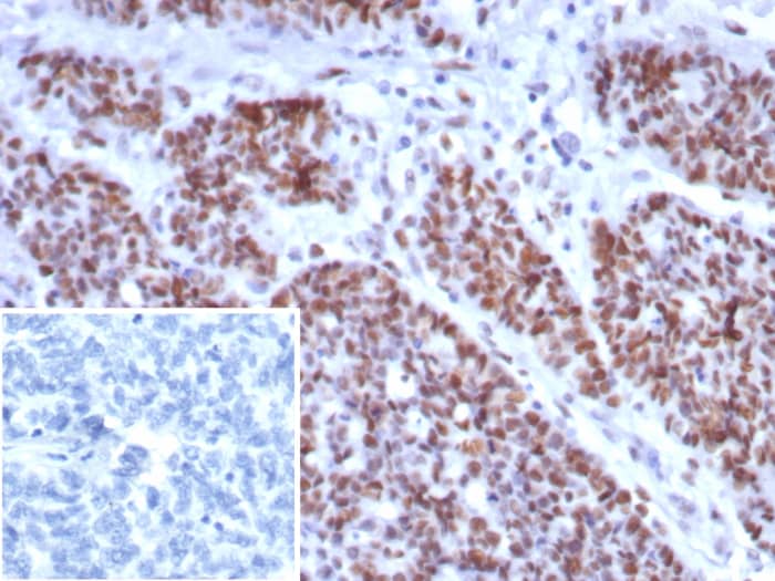 MSH6 Antibody (rMSH6/8337)