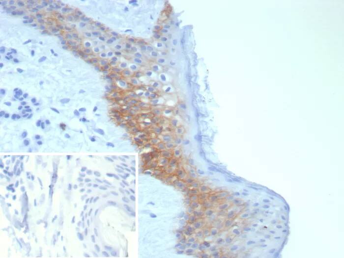 Desmoglein-3 Antibody (DSG3/8252R) Immunohistochemistry-Paraffin: Desmoglein-3 Antibody (DSG3/8252R) [NBP3-23750] -