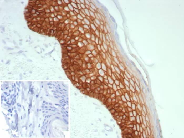 Desmoglein-3 Antibody (DSG3/8613R) Immunohistochemistry-Paraffin: Desmoglein-3 Antibody (DSG3/8613R) [NBP3-23751] -