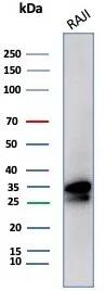 CD20 Antibody (MS4A1/8072R) Western Blot: CD20 Antibody (MS4A1/8072R) [NBP3-23754] -