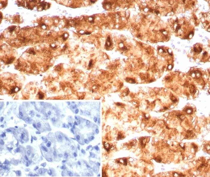 Lewis Y Antibody (LWY/9243R) Immunohistochemistry-Paraffin: Lewis Y Antibody (LWY/9243R) [NBP3-23755] -