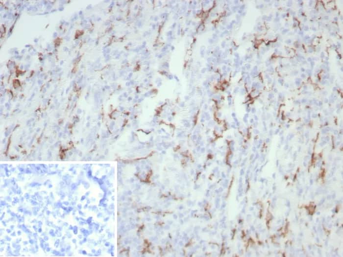 CD163 Antibody (rM130/8823) Immunohistochemistry-Paraffin: CD163 Antibody (rM130/8823) [NBP3-23756] -