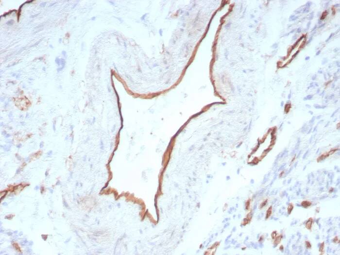 CD31/PECAM-1 Antibody (C31/8831R) Immunohistochemistry-Paraffin: CD31/PECAM-1 Antibody (C31/8831R) [NBP3-23758] -