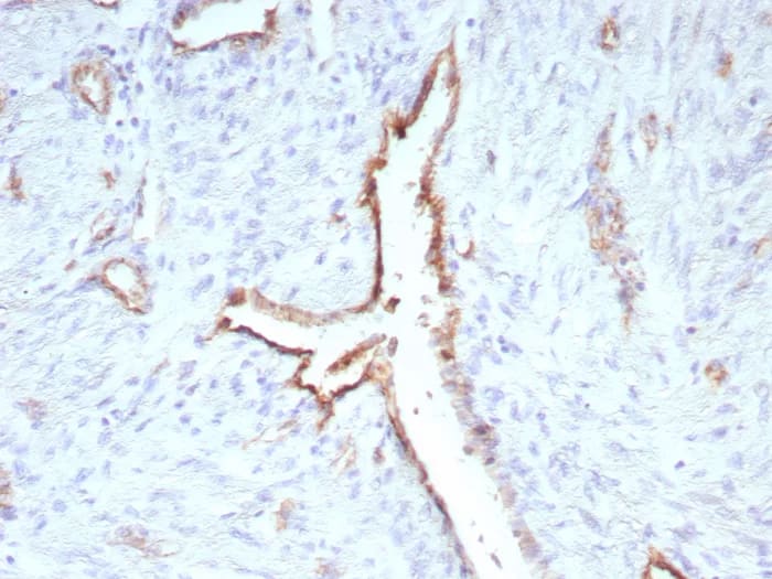 CD31/PECAM-1 Antibody (C31/9224R) Immunohistochemistry-Paraffin: CD31/PECAM-1 Antibody (C31/9224R) [NBP3-23759] -