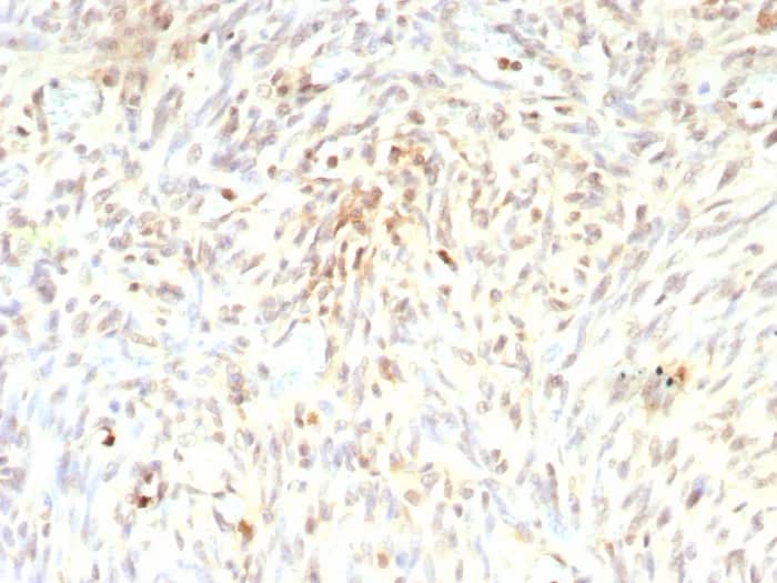 MDM2/HDM2 Antibody (rMDM2/9214) Immunohistochemistry-Paraffin: MDM2/HDM2 Antibody (rMDM2/9214) [NBP3-23760] -