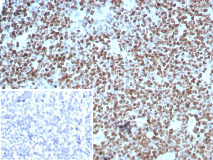 Ki67/MKI67 Antibody (rMKI67/8852) Immunohistochemistry-Paraffin: Ki67/MKI67 Antibody (rMKI67/8852) [NBP3-23761] -