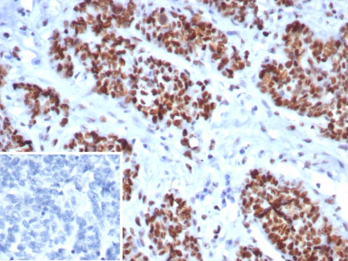 MSH6 Antibody (MSH6/8338R)