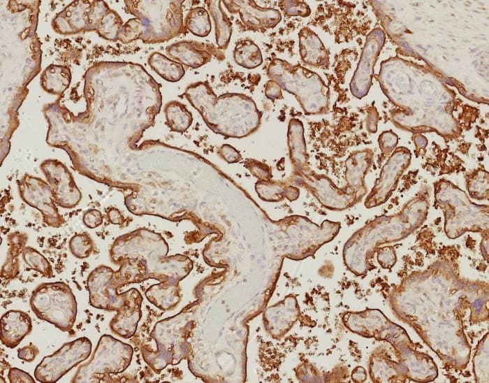 EGFR Antibody (EGFR/9166R) Immunohistochemistry-Paraffin: EGFR Antibody (EGFR/9166R) [NBP3-23767] -