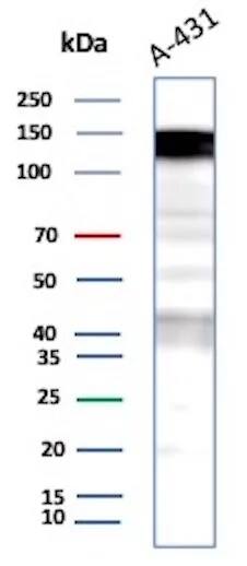 EGFR Antibody (EGFR/9166R) Western Blot: EGFR Antibody (EGFR/9166R) [NBP3-23767] -