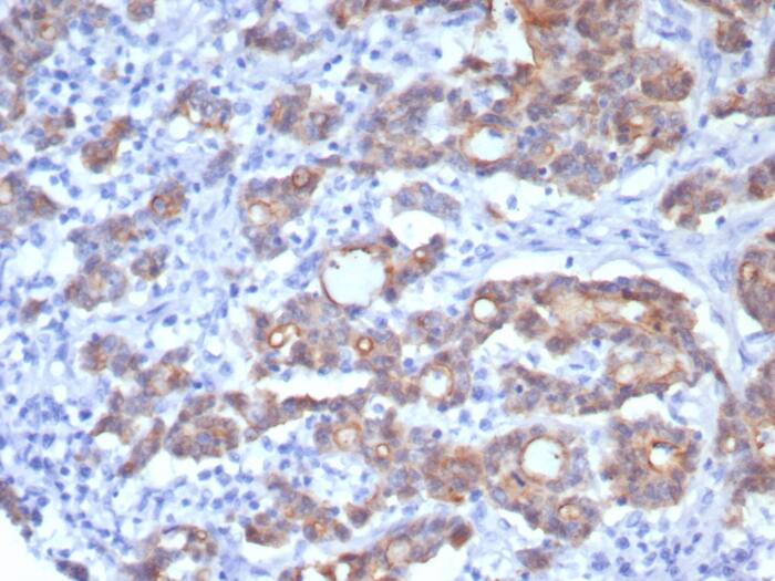 Villin 1 Antibody (rVIL1/8336)