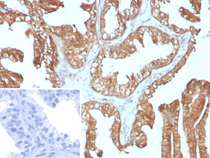 RPS23 Antibody (rYWHAE/8860)