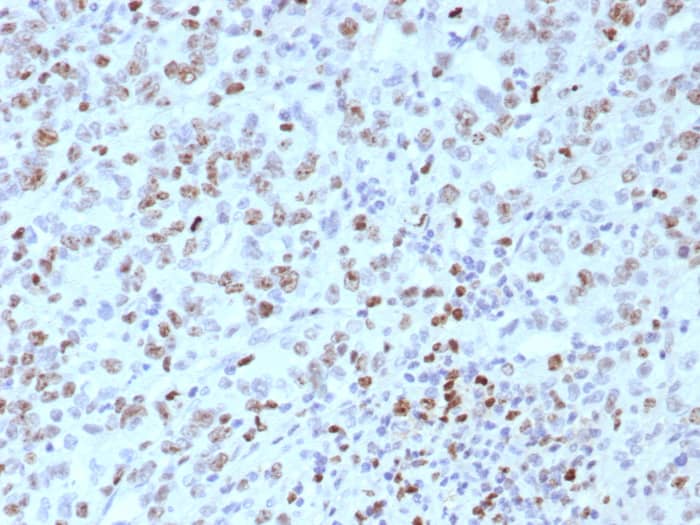 MLH1 Antibody (rMLH1/8630)