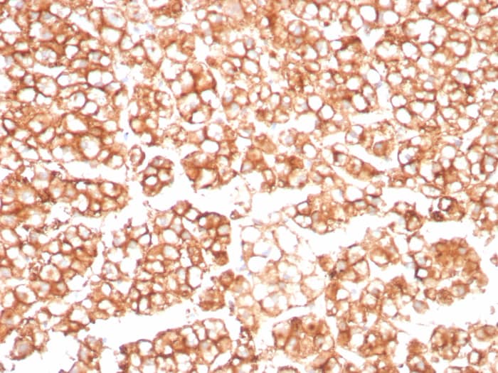 MDR1/ABCB1 Antibody (MDR1/8962R)