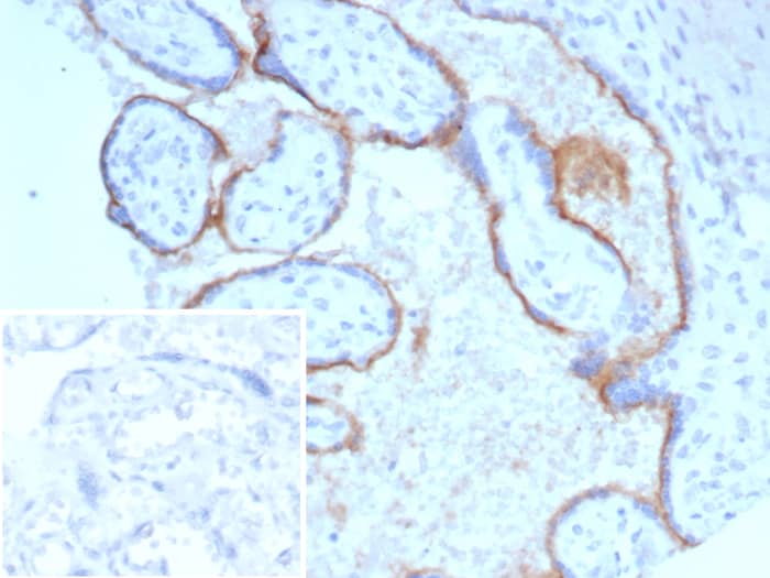 Endoglin/CD105 Antibody (ENG/8069R)