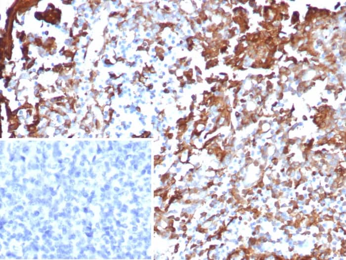 Annexin A1 Antibody (rANXA1/6451) Immunohistochemistry-Paraffin: Annexin A1 Antibody (rANXA1/6451) [NBP3-23779] -