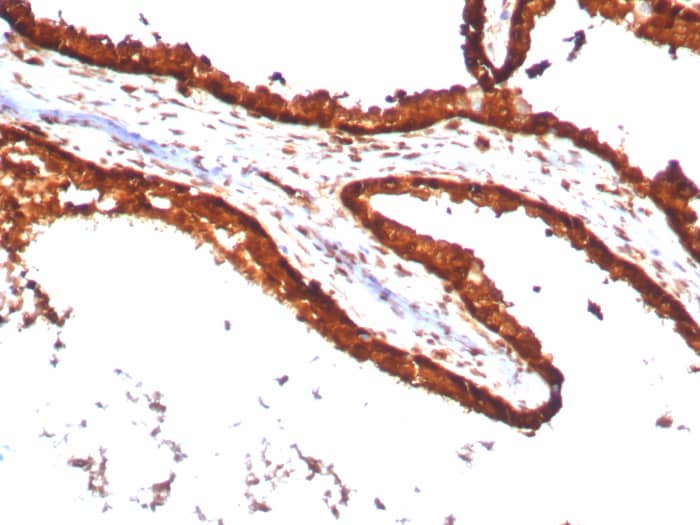 RPS23 Antibody (YWHAE/8636R)