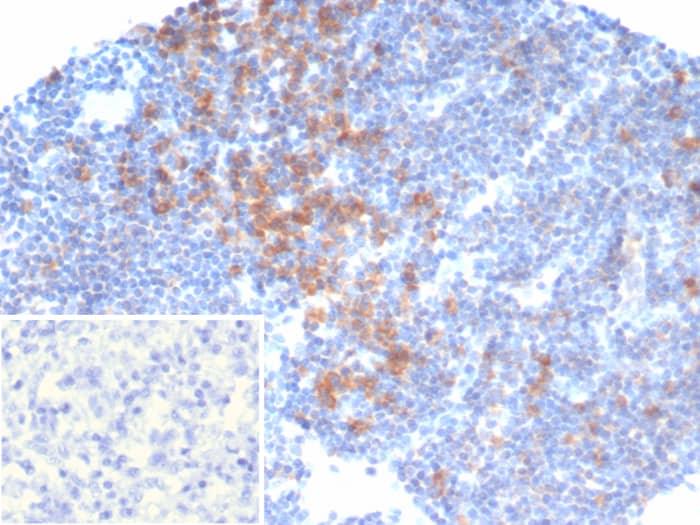 PI 3-Kinase p110 delta Antibody (PIK3CD/4639)