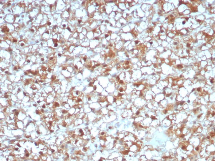 ALDH1L1 Antibody (ALDH1L1/7969)