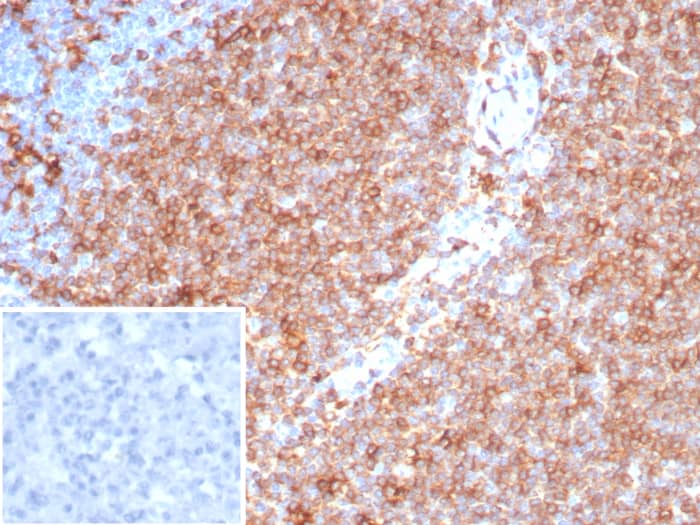 HLA DQ/DR/DP Antibody (HLA-Pan/8311R)