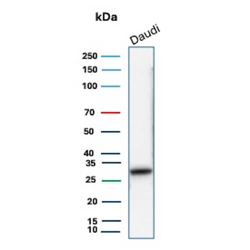 HLA DQ/DR/DP Antibody (HLA-Pan/8311R) Western Blot: HLA DQ/DR/DP Antibody (HLA-Pan/8311R) [NBP3-23787] -