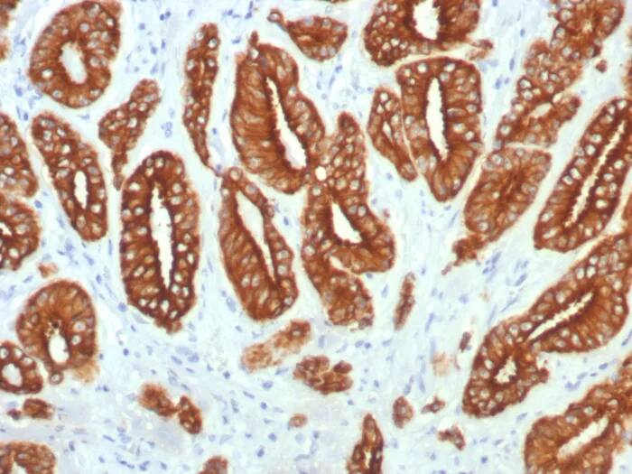 Cytokeratin, LMW Antibody (KRTL/7784R) Immunohistochemistry-Paraffin: Cytokeratin, LMW Antibody (KRTL/7784R) [NBP3-23788] -