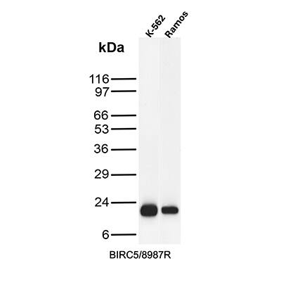 Survivin Antibody (BIRC5/8987R) Western Blot: Survivin Antibody (BIRC5/8987R) [NBP3-23789] -