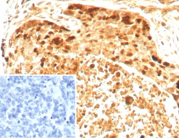 Survivin Antibody (BIRC5/8936R) Immunohistochemistry-Paraffin: Survivin Antibody (BIRC5/8936R) [NBP3-23790] -