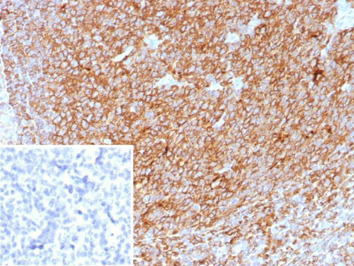 HLA DQ/DR/DP Antibody (HLA-Pan/8622R)