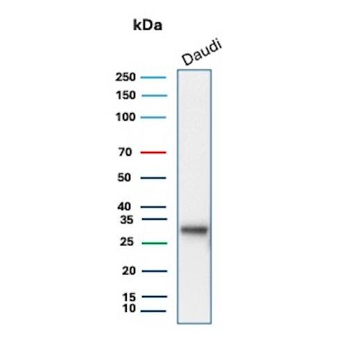 HLA DQ/DR/DP Antibody (HLA-Pan/8622R) Western Blot: HLA DQ/DR/DP Antibody (HLA-Pan/8622R) [NBP3-23793] -