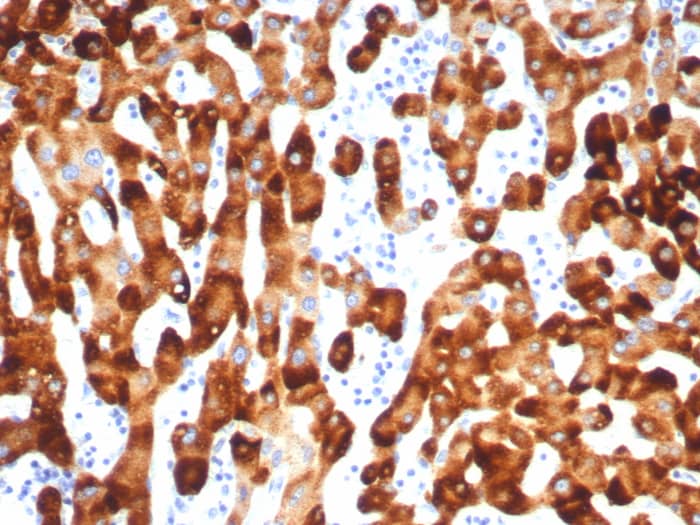 HBsAg Antibody (HBsAg/7556R)