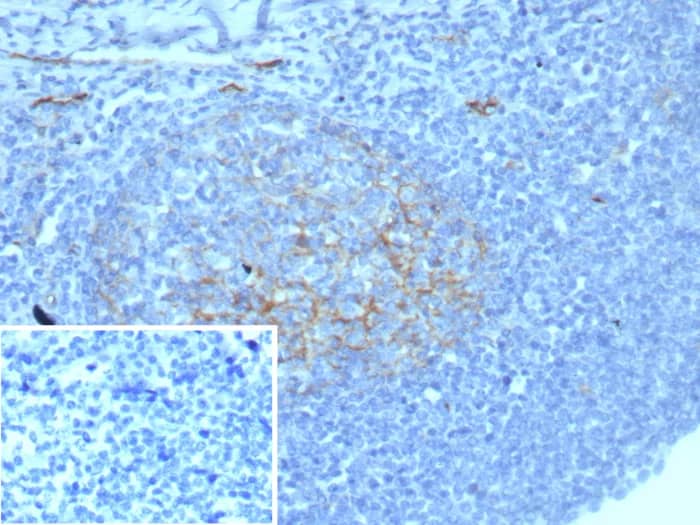 ICAM-1/CD54 Antibody (ICAM1/8677R) Immunohistochemistry-Paraffin: ICAM-1/CD54 Antibody (ICAM1/8677R) [NBP3-23795] -